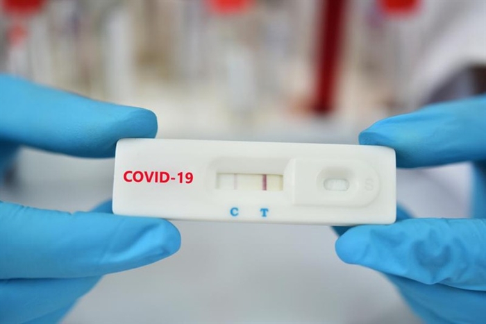 Cần triển khai test nhanh COVID bảo vệ các cơ sở y tế TP.HCM - antv